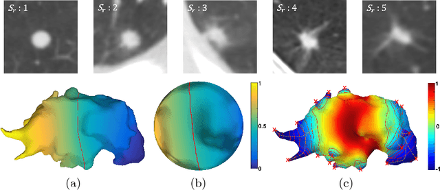 Figure 1 for Interpretable Spiculation Quantification for Lung Cancer Screening