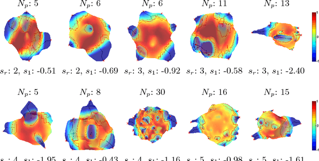 Figure 3 for Interpretable Spiculation Quantification for Lung Cancer Screening