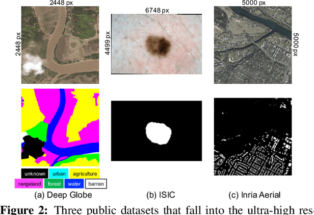 Figure 2 for Collaborative Global-Local Networks for Memory-Efficient Segmentation of Ultra-High Resolution Images