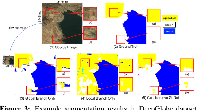 Figure 4 for Collaborative Global-Local Networks for Memory-Efficient Segmentation of Ultra-High Resolution Images