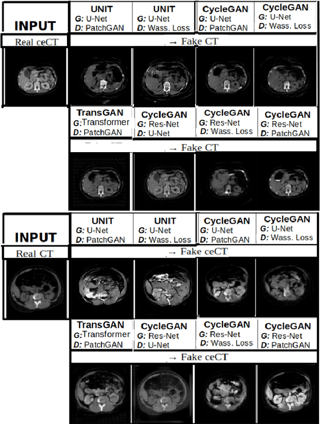 Figure 3 for Anatomically constrained CT image translation for heterogeneous blood vessel segmentation