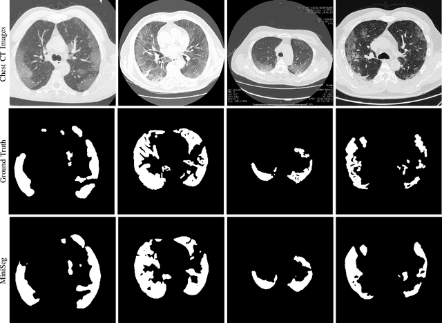 Figure 3 for MiniSeg: An Extremely Minimum Network for Efficient COVID-19 Segmentation