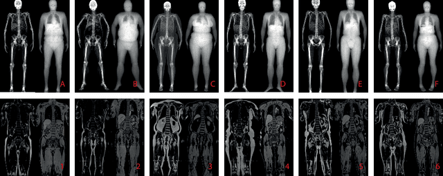 Figure 1 for Self-Supervised Multi-Modal Alignment for Whole Body Medical Imaging
