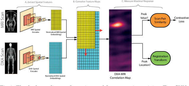 Figure 3 for Self-Supervised Multi-Modal Alignment for Whole Body Medical Imaging