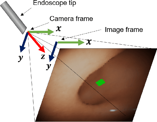 Figure 3 for Colonoscopy Navigation using End-to-End Deep Visuomotor Control: A User Study