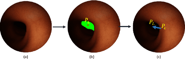 Figure 4 for Colonoscopy Navigation using End-to-End Deep Visuomotor Control: A User Study