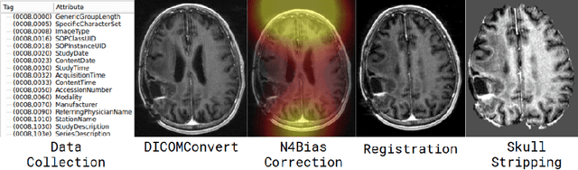 Figure 3 for DeepNeuro: an open-source deep learning toolbox for neuroimaging