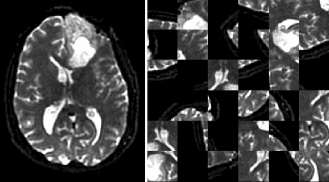 Figure 4 for DeepNeuro: an open-source deep learning toolbox for neuroimaging