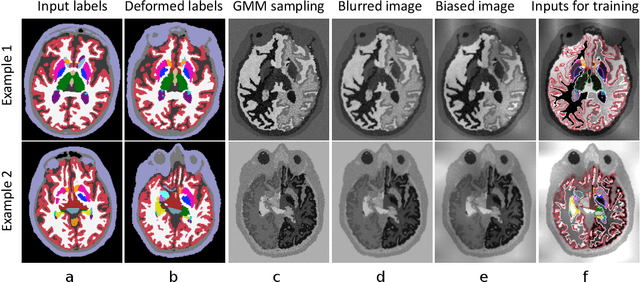Figure 3 for A Learning Strategy for Contrast-agnostic MRI Segmentation
