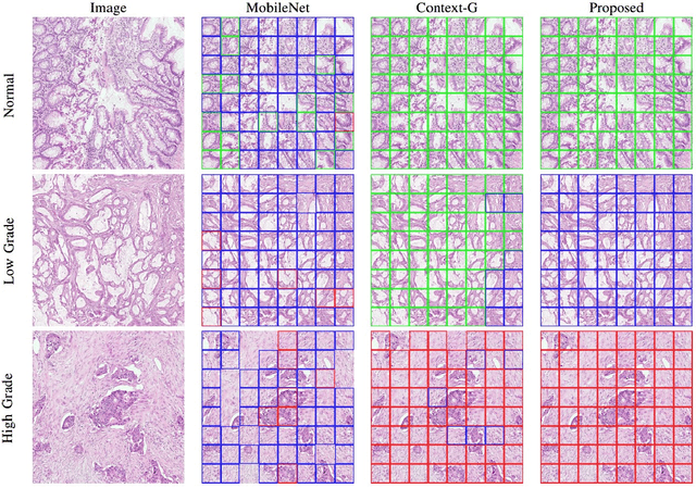 Figure 4 for Context-Aware Convolutional Neural Network for Grading of Colorectal Cancer Histology Images