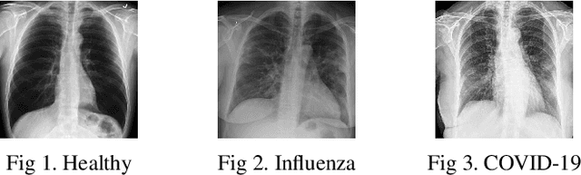 Figure 1 for COVID-19 Pneumonia and Influenza Pneumonia Detection Using Convolutional Neural Networks