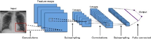 Figure 2 for COVID-19 Pneumonia and Influenza Pneumonia Detection Using Convolutional Neural Networks
