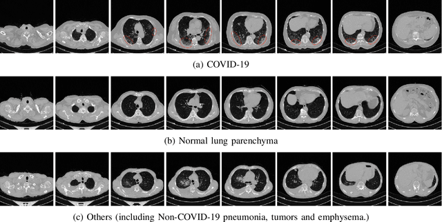 Figure 1 for COVID-19 Detection in Computed Tomography Images with 2D and 3D Approaches