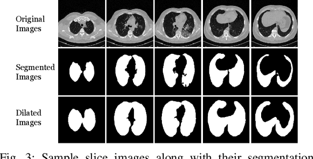 Figure 3 for COVID-19 Detection in Computed Tomography Images with 2D and 3D Approaches