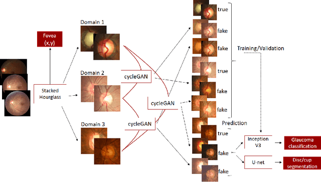 Figure 3 for EyeLoveGAN: Exploiting domain-shifts to boost network learning with cycleGANs