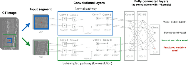 Figure 3 for Detection of vertebral fractures in CT using 3D Convolutional Neural Networks