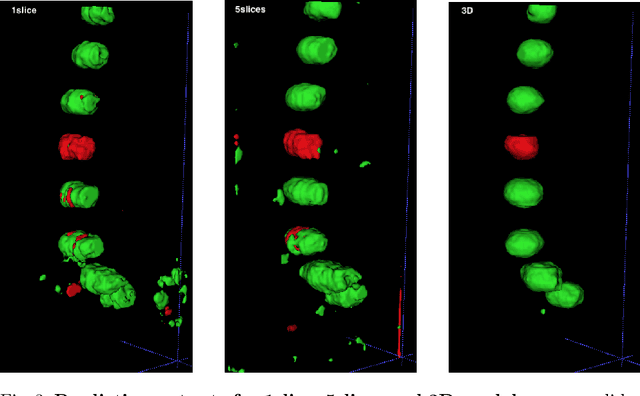 Figure 4 for Detection of vertebral fractures in CT using 3D Convolutional Neural Networks