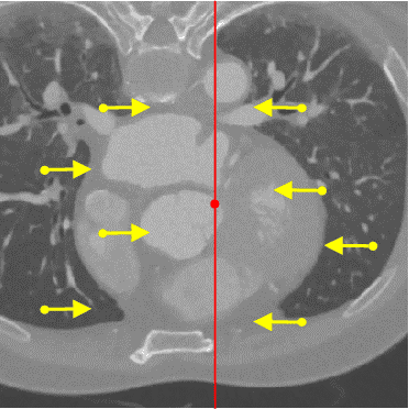 Figure 2 for Partial Policy-based Reinforcement Learning for Anatomical Landmark Localization in 3D Medical Images