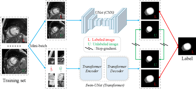 Figure 1 for Semi-Supervised Medical Image Segmentation via Cross Teaching between CNN and Transformer