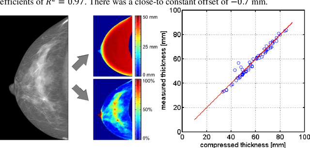 Figure 3 for Volumetric breast-density measurement using spectral photon-counting tomosynthesis: First clinical results