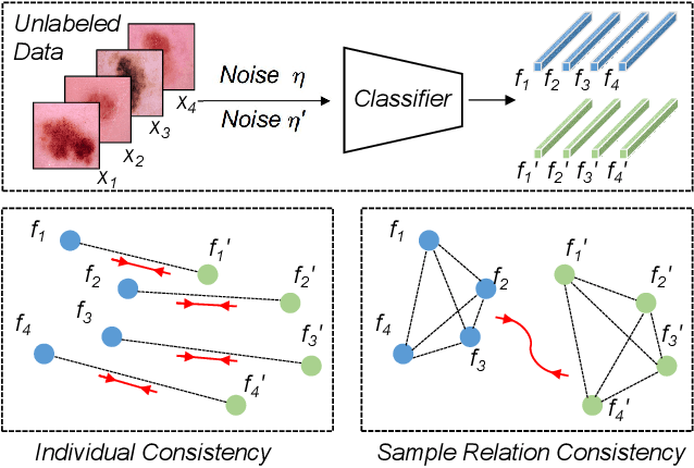 Figure 1 for Semi-supervised Medical Image Classification with Relation-driven Self-ensembling Model