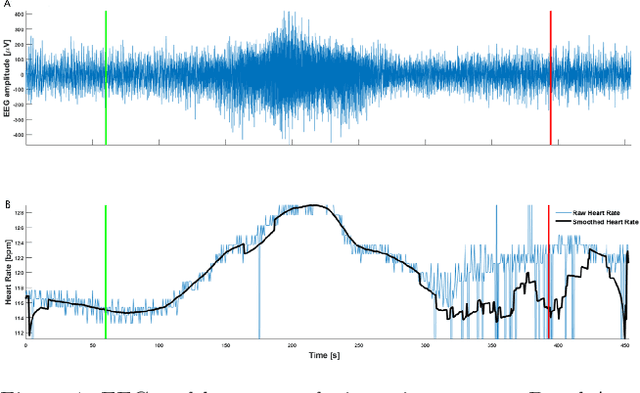 Figure 1 for Machine Learning to Support Triage of Children at Risk for Epileptic Seizures in the Pediatric Intensive Care Unit