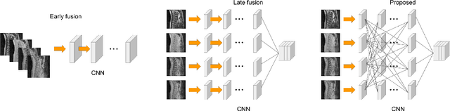 Figure 1 for IVD-Net: Intervertebral disc localization and segmentation in MRI with a multi-modal UNet