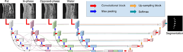 Figure 3 for IVD-Net: Intervertebral disc localization and segmentation in MRI with a multi-modal UNet
