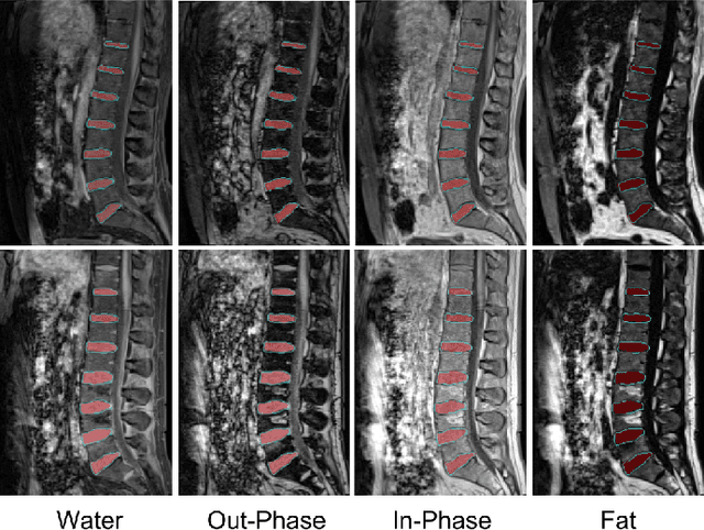 Figure 2 for IVD-Net: Intervertebral disc localization and segmentation in MRI with a multi-modal UNet