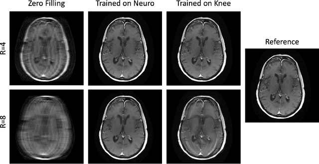 Figure 4 for Physics-Driven Deep Learning for Computational Magnetic Resonance Imaging