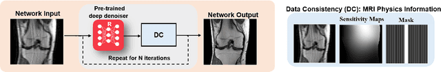 Figure 1 for Physics-Driven Deep Learning for Computational Magnetic Resonance Imaging