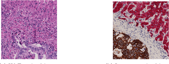 Figure 1 for GAN-based Virtual Re-Staining: A Promising Solution for Whole Slide Image Analysis