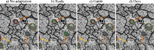 Figure 3 for Adversarial-Prediction Guided Multi-task Adaptation for Semantic Segmentation of Electron Microscopy Images