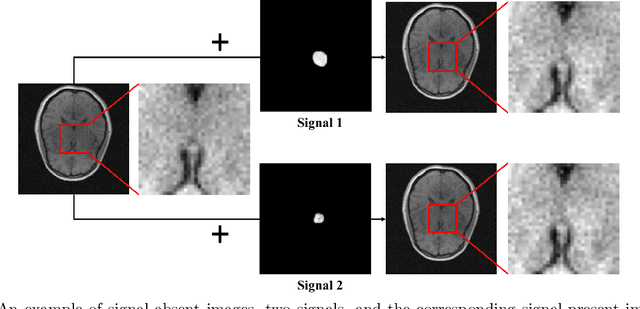 Figure 3 for Progressively-Growing AmbientGANs For Learning Stochastic Object Models From Imaging Measurements