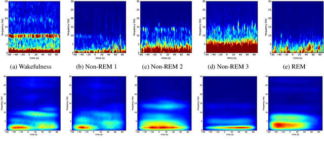 Figure 2 for Deep Convolutional Neural Networks for Interpretable Analysis of EEG Sleep Stage Scoring