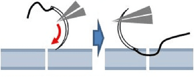 Figure 2 for MIcro-Surgical Anastomose Workflow recognition challenge report