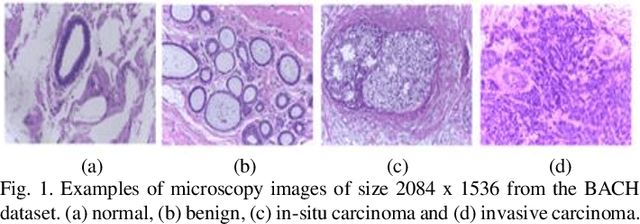Figure 1 for Classification of Microscopy Images of Breast Tissue: Region Duplication based Self-Supervision vs. Off-the Shelf Deep Representations
