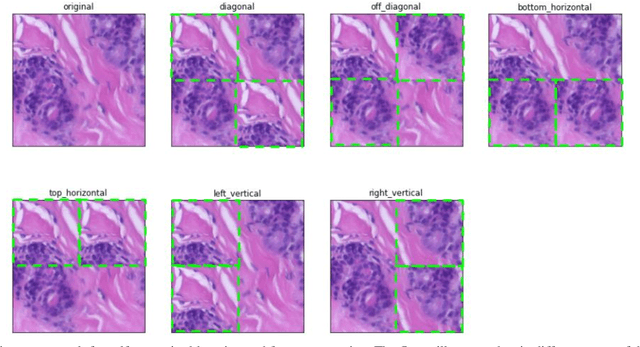 Figure 2 for Classification of Microscopy Images of Breast Tissue: Region Duplication based Self-Supervision vs. Off-the Shelf Deep Representations