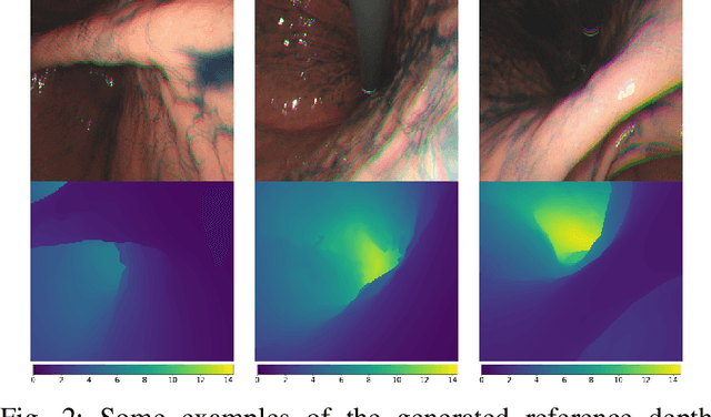 Figure 2 for Learning-Based Depth and Pose Estimation for Monocular Endoscope with Loss Generalization