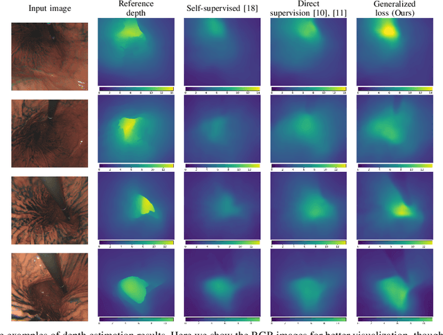 Figure 3 for Learning-Based Depth and Pose Estimation for Monocular Endoscope with Loss Generalization
