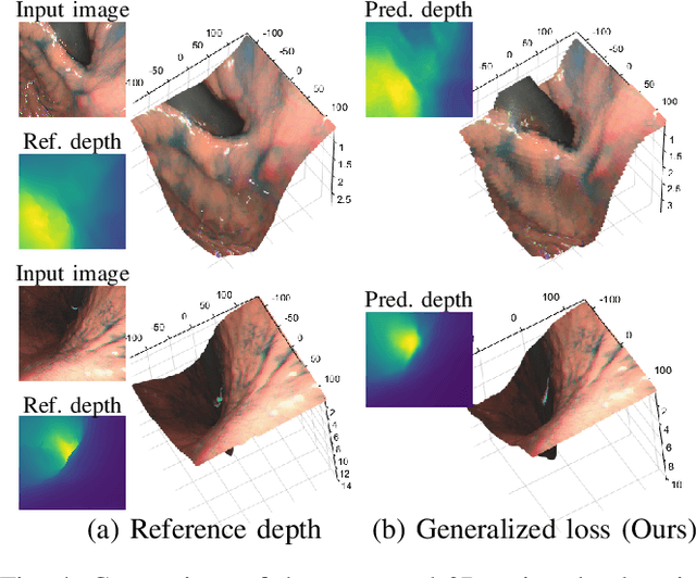 Figure 4 for Learning-Based Depth and Pose Estimation for Monocular Endoscope with Loss Generalization