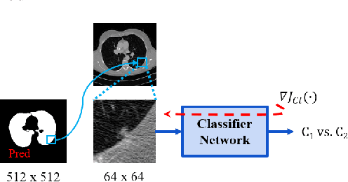 Figure 4 for Lung Segmentation and Nodule Detection in Computed Tomography Scan using a Convolutional Neural Network Trained Adversarially using Turing Test Loss
