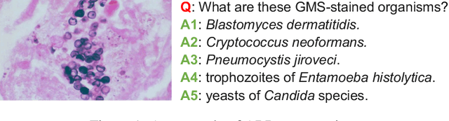 Figure 1 for PathVQA: 30000+ Questions for Medical Visual Question Answering