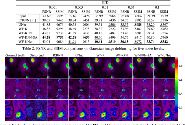 Figure 3 for Microscopy Image Restoration with Deep Wiener-Kolmogorov filters