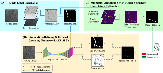 Figure 3 for Weakly Supervised Vessel Segmentation in X-ray Angiograms by Self-Paced Learning from Noisy Labels with Suggestive Annotation