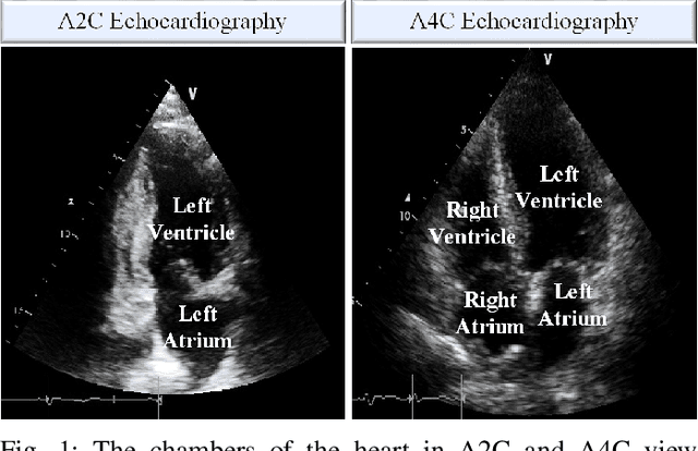 Figure 1 for Early Myocardial Infarction Detection over Multi-view Echocardiography