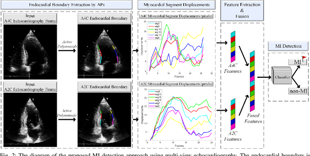 Figure 4 for Early Myocardial Infarction Detection over Multi-view Echocardiography