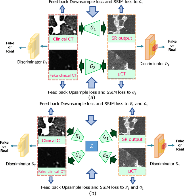 Figure 1 for Multi-modality super-resolution loss for GAN-based super-resolution of clinical CT images using micro CT image database