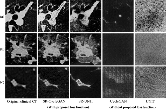 Figure 2 for Multi-modality super-resolution loss for GAN-based super-resolution of clinical CT images using micro CT image database