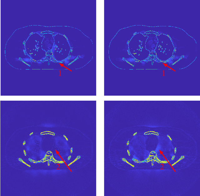 Figure 3 for DECT-MULTRA: Dual-Energy CT Image Decomposition With Learned Mixed Material Models and Efficient Clustering
